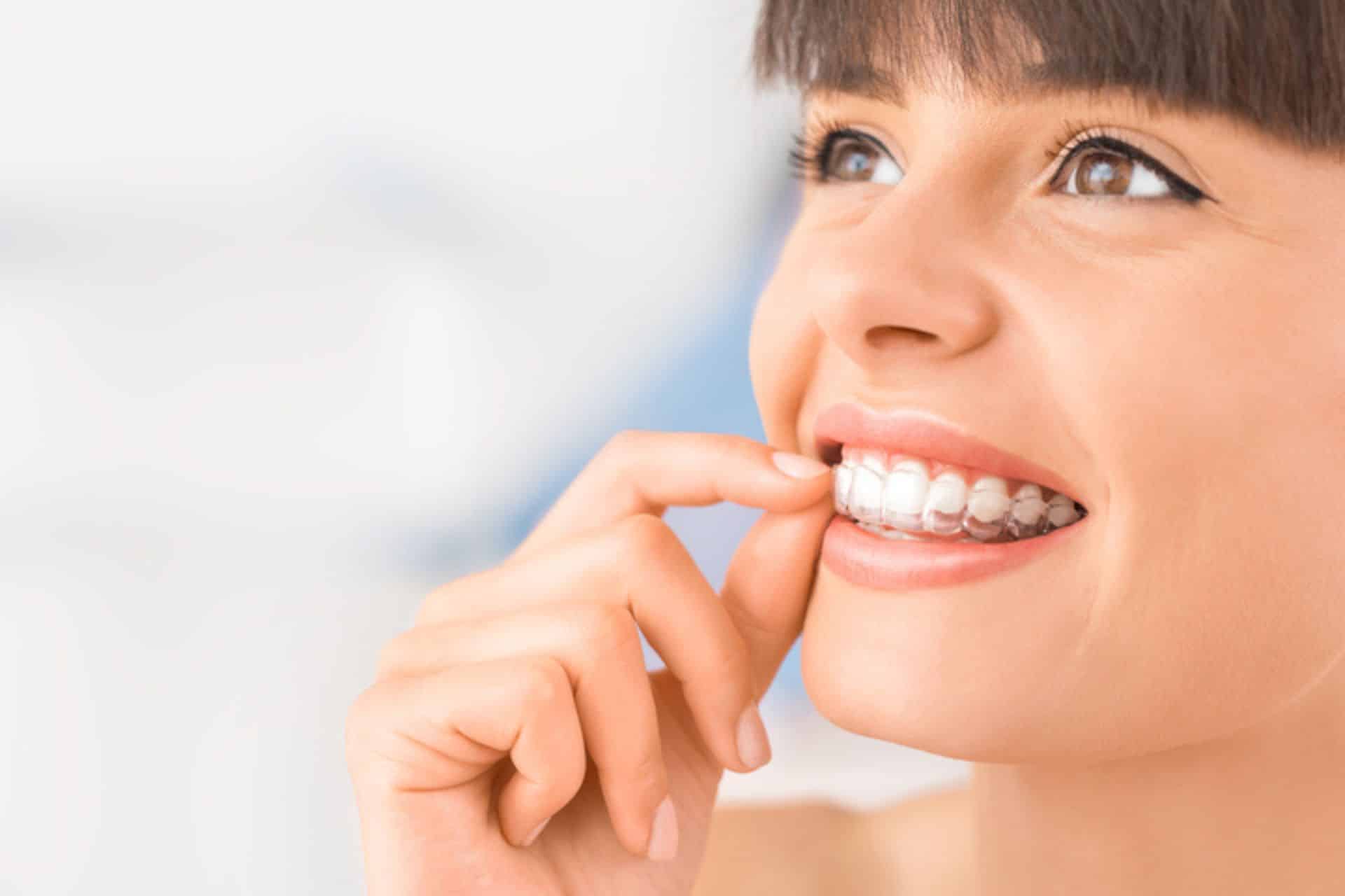 How Do I Know If I Need Braces or Clear Aligners? Enoch and Lamei Orthodontics in Marietta and Roswell, GA